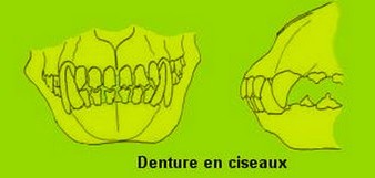 dentition-ciseaux